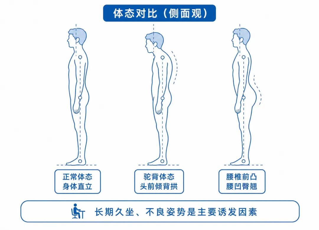 体态对比（侧面）.jpg