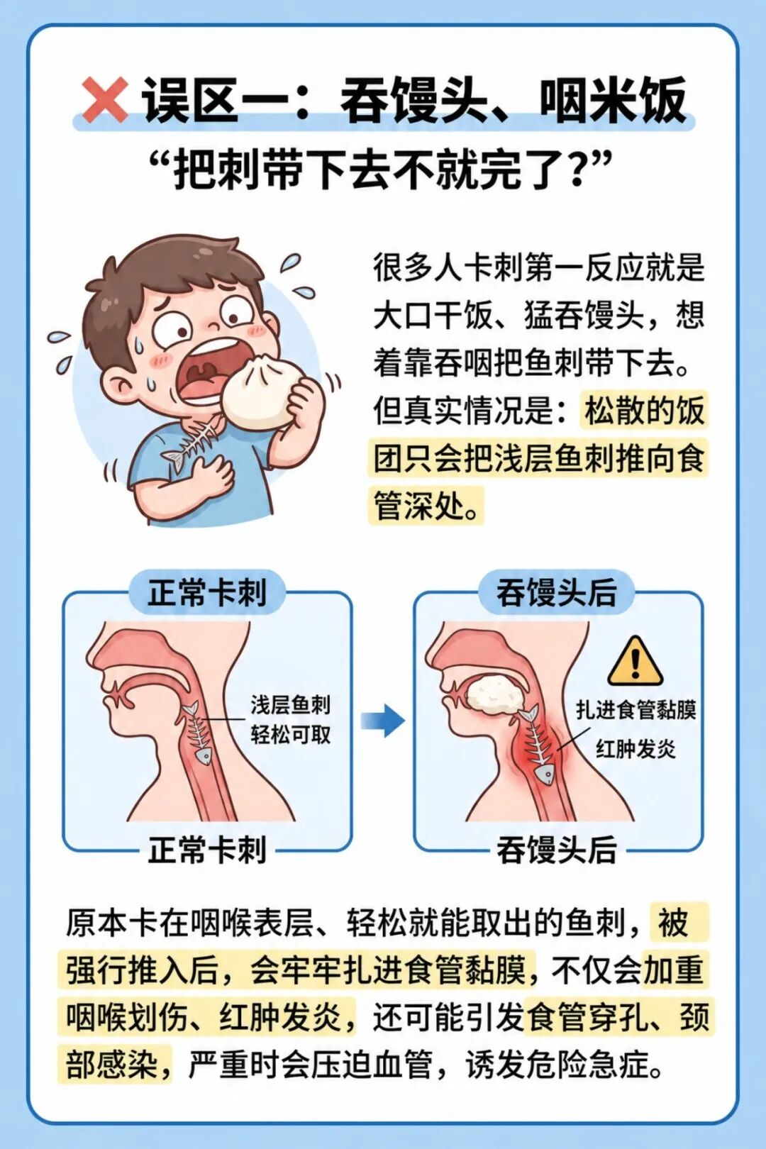 鱼刺卡喉处理指南.jpg
