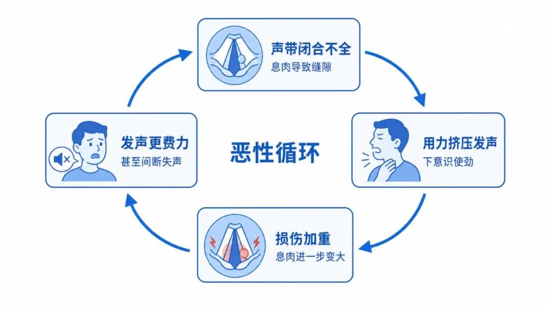 恶性循环声带科普图.jpg