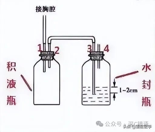 三腔引流管有哪些胸腔闭式引流瓶单腔、双腔、三腔胸腔引流瓶的区别及注意事项_https://www.jmylbn.com_新闻资讯_第4张