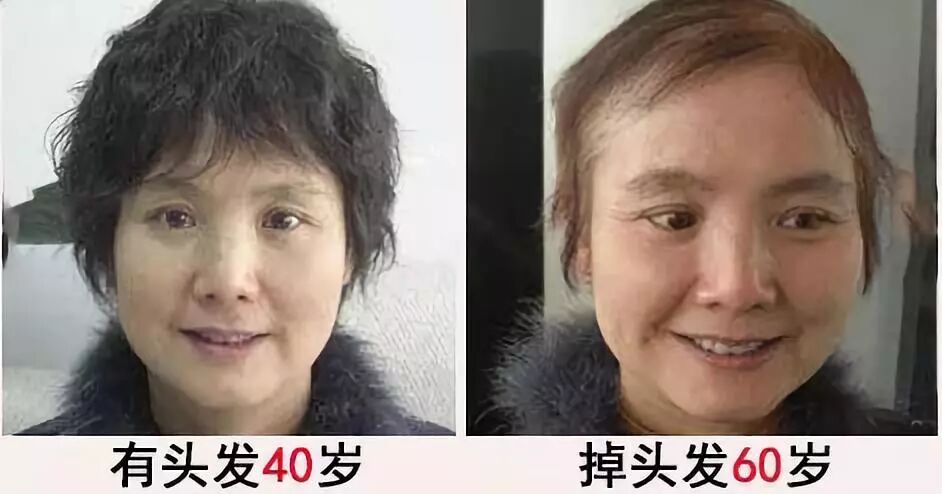 洗发水里加这个！减少掉发情况，还能控油去头屑！