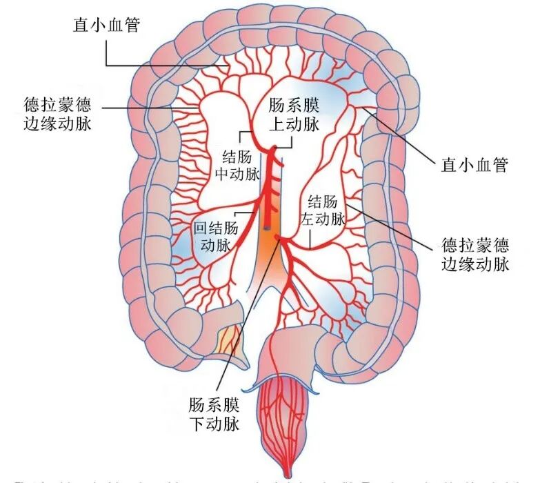 两个易发生缺血的区域是①右回结肠动脉的末端——距离肠系膜上动脉的