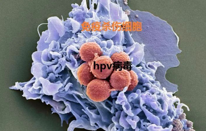 Hpv和tct检查有什么区别 全网搜