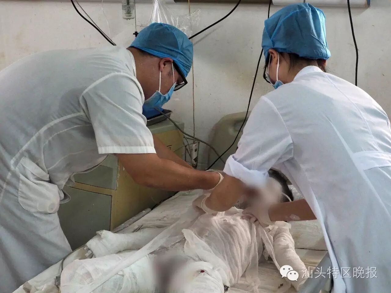 市二医院全力抢救三名煤气爆炸特重烧伤患儿