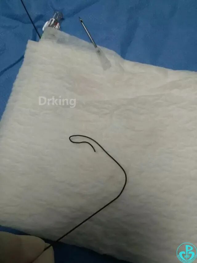 泥鳅导丝怎么用想着容易做着难：演示如何给泥鳅导丝塑“U”弯！_https://www.jmylbn.com_新闻资讯_第9张