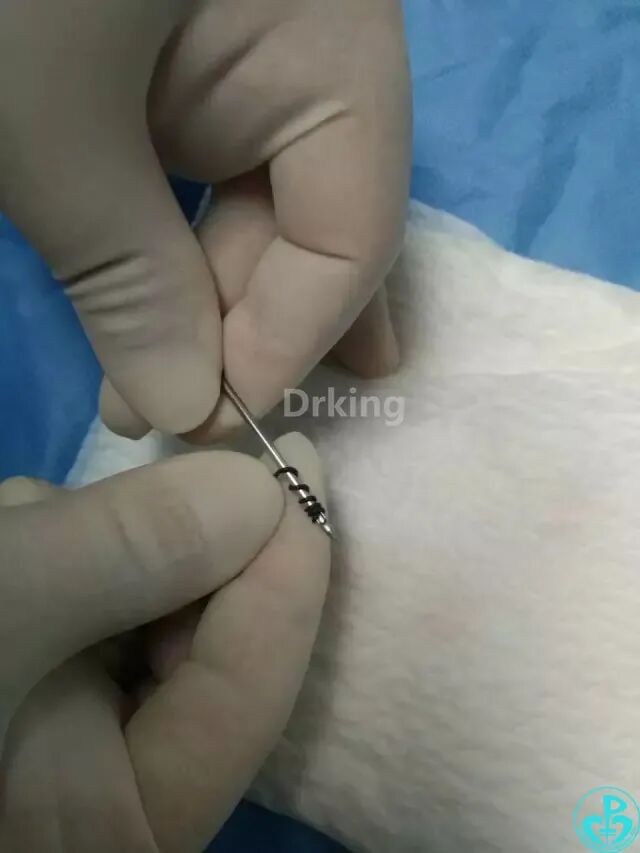 泥鳅导丝怎么用想着容易做着难：演示如何给泥鳅导丝塑“U”弯！_https://www.jmylbn.com_新闻资讯_第5张