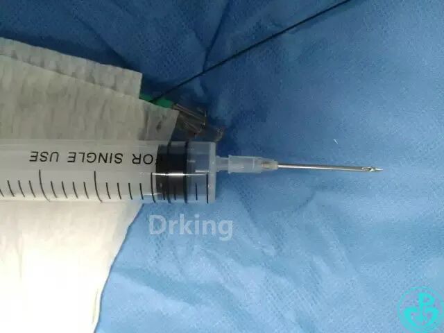 泥鳅导丝怎么用想着容易做着难：演示如何给泥鳅导丝塑“U”弯！_https://www.jmylbn.com_新闻资讯_第3张