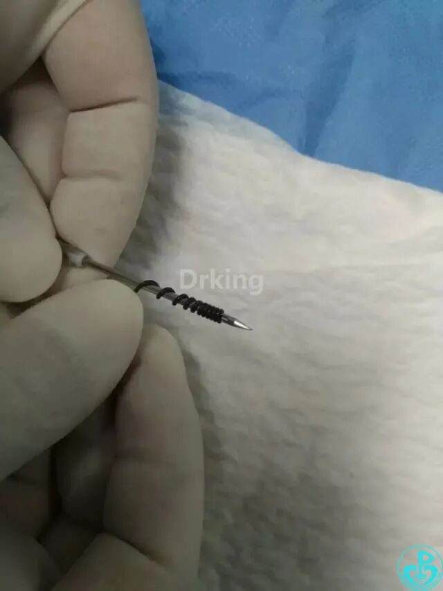 泥鳅导丝怎么用想着容易做着难：演示如何给泥鳅导丝塑“U”弯！_https://www.jmylbn.com_新闻资讯_第6张