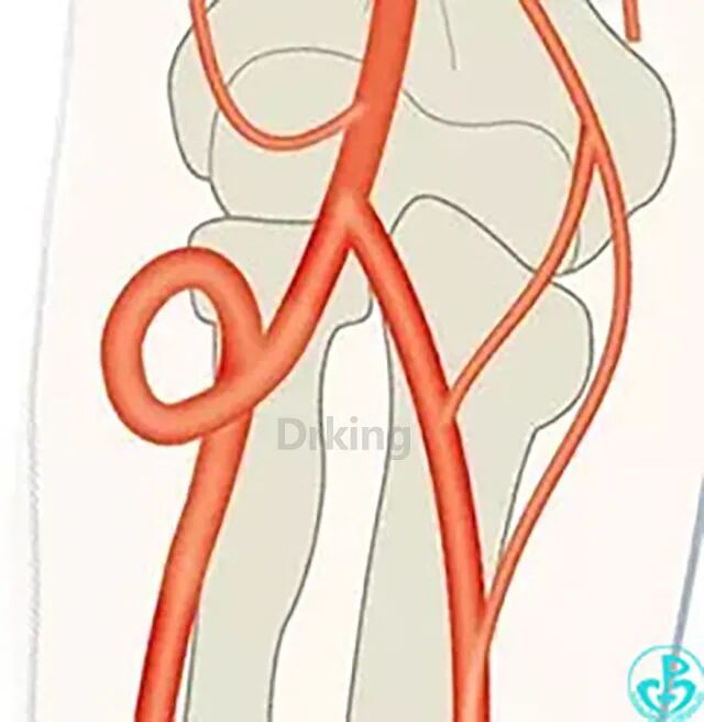 泥鳅导丝怎么用想着容易做着难：演示如何给泥鳅导丝塑“U”弯！_https://www.jmylbn.com_新闻资讯_第10张