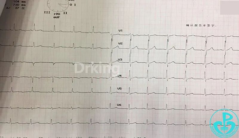 act什么监测项目长时间手术操作一定要监测ACT，防止术中新生血栓！-上海聚慕医疗器械有限公司