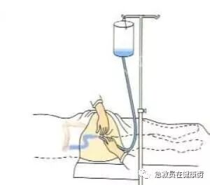 怎么无器材灌肠灌肠术（一）_https://www.jmylbn.com_新闻资讯_第24张