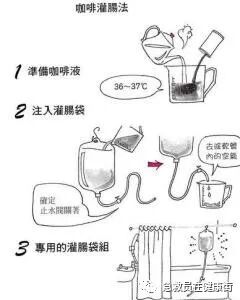 怎么无器材灌肠灌肠术（一）_https://www.jmylbn.com_新闻资讯_第15张