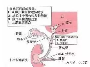 怎么无器材灌肠灌肠术（一）_https://www.jmylbn.com_新闻资讯_第16张