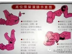 怎么无器材灌肠灌肠术（一）_https://www.jmylbn.com_新闻资讯_第11张