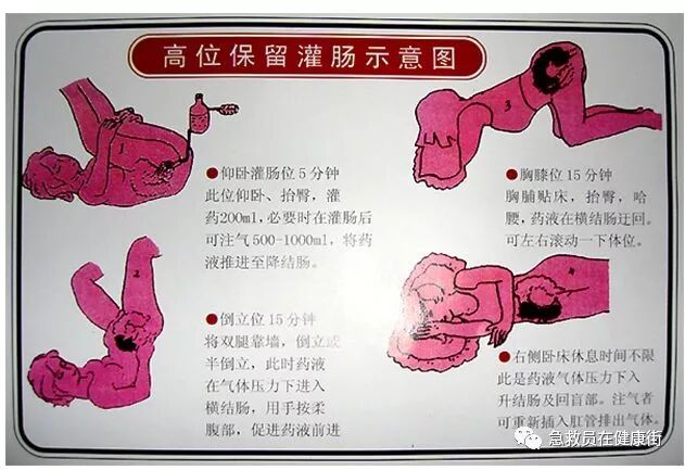 怎么无器材灌肠灌肠术（一）_https://www.jmylbn.com_新闻资讯_第6张