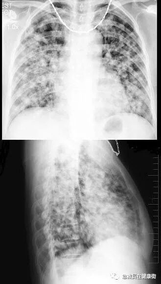 x光什么频率医学X线检查（一）-上海聚慕医疗器械有限公司