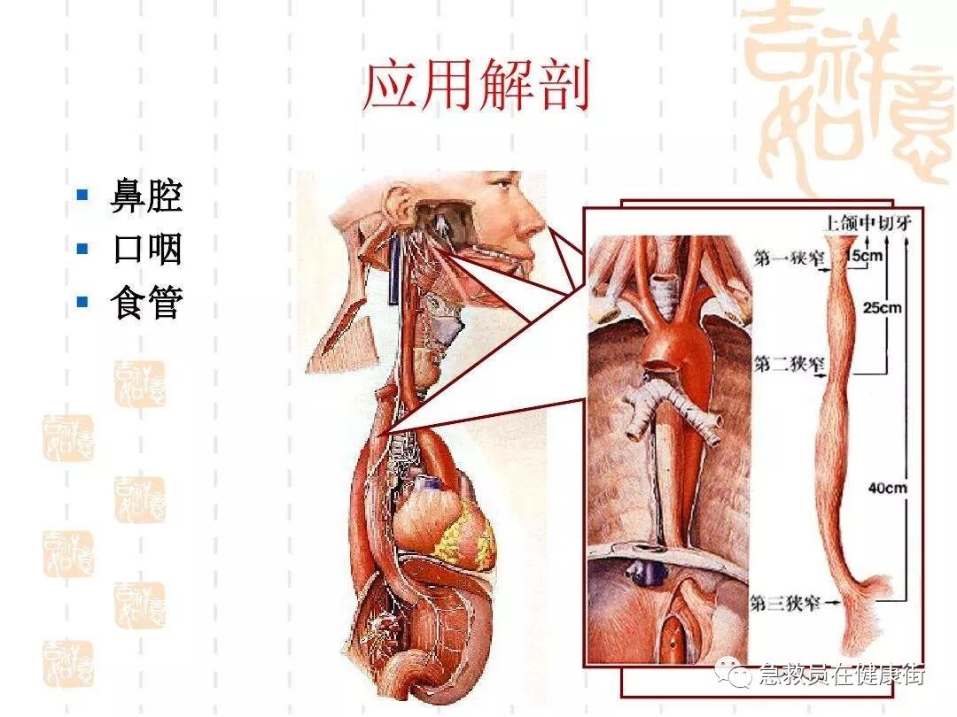 怎么拔鼻腔引流管胃管术（二）_https://www.jmylbn.com_新闻资讯_第19张