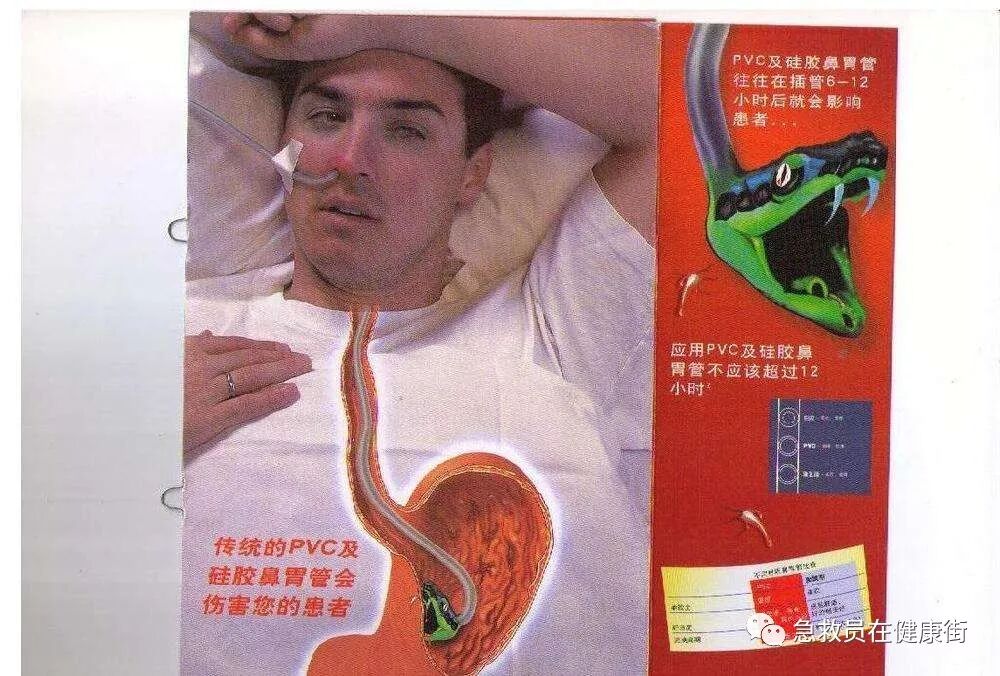 怎么拔鼻腔引流管胃管术（二）_https://www.jmylbn.com_新闻资讯_第32张