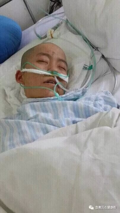 怎么拔鼻腔引流管胃管术（二）_https://www.jmylbn.com_新闻资讯_第9张