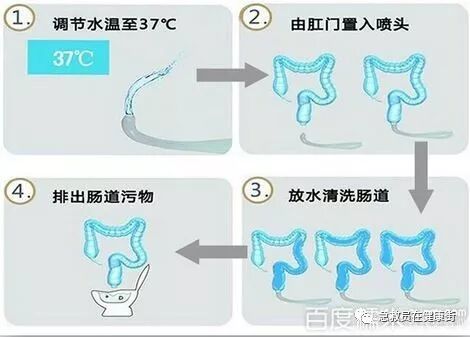 结肠水疗仪怎么用中医---结肠水疗_https://www.jmylbn.com_新闻资讯_第1张
