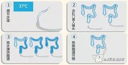 结肠水疗仪怎么用中医---结肠水疗_https://www.jmylbn.com_新闻资讯_第10张