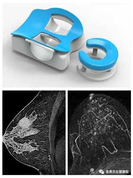 穿刺枪怎么升级乳腺穿刺术（三）_https://www.jmylbn.com_新闻资讯_第18张