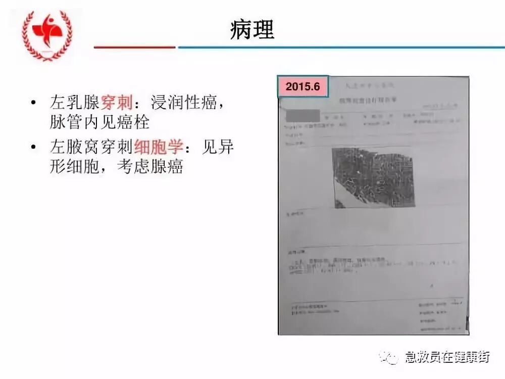 穿刺枪怎么升级乳腺穿刺术（二）_https://www.jmylbn.com_新闻资讯_第10张