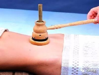 不打针、不输液，中医特色诊疗体系之上古脐疗