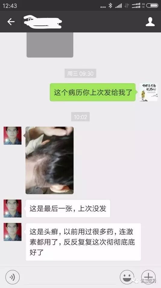 【案例分享】佑三复方芩芍樟脑软膏治愈头癣见奇效！