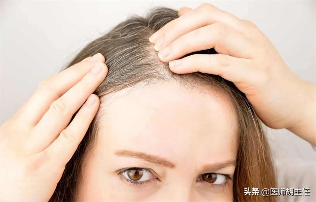 为什么白头发越长越多？你以为是老了，提醒：或是缺乏2种营养素
