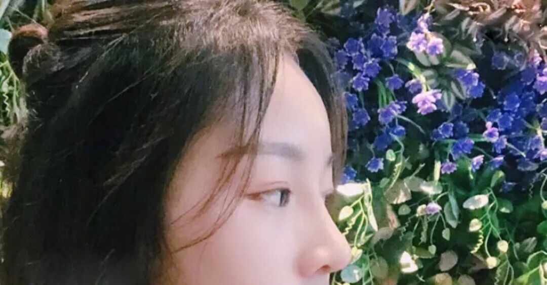 鼻部手术一个月恢复日记分享~