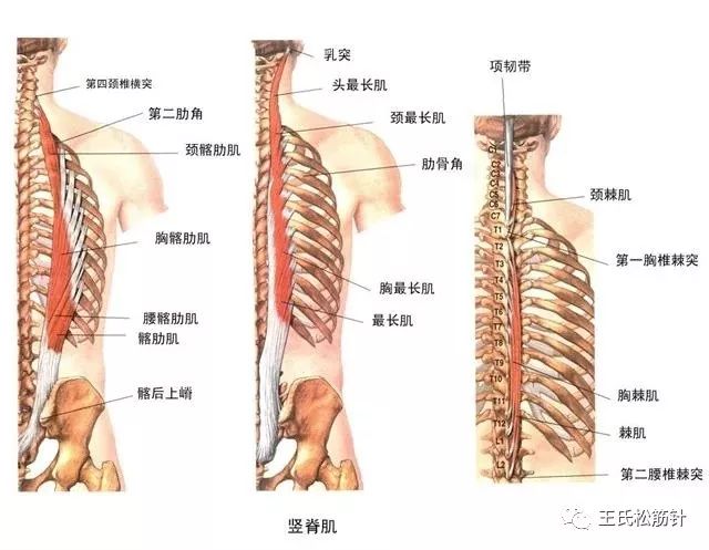 竖脊肌群损伤引起的颈肩背腰疼痛 脊柱侧弯 肩高低等 王氏松筋针 微信公众号文章阅读 Wemp