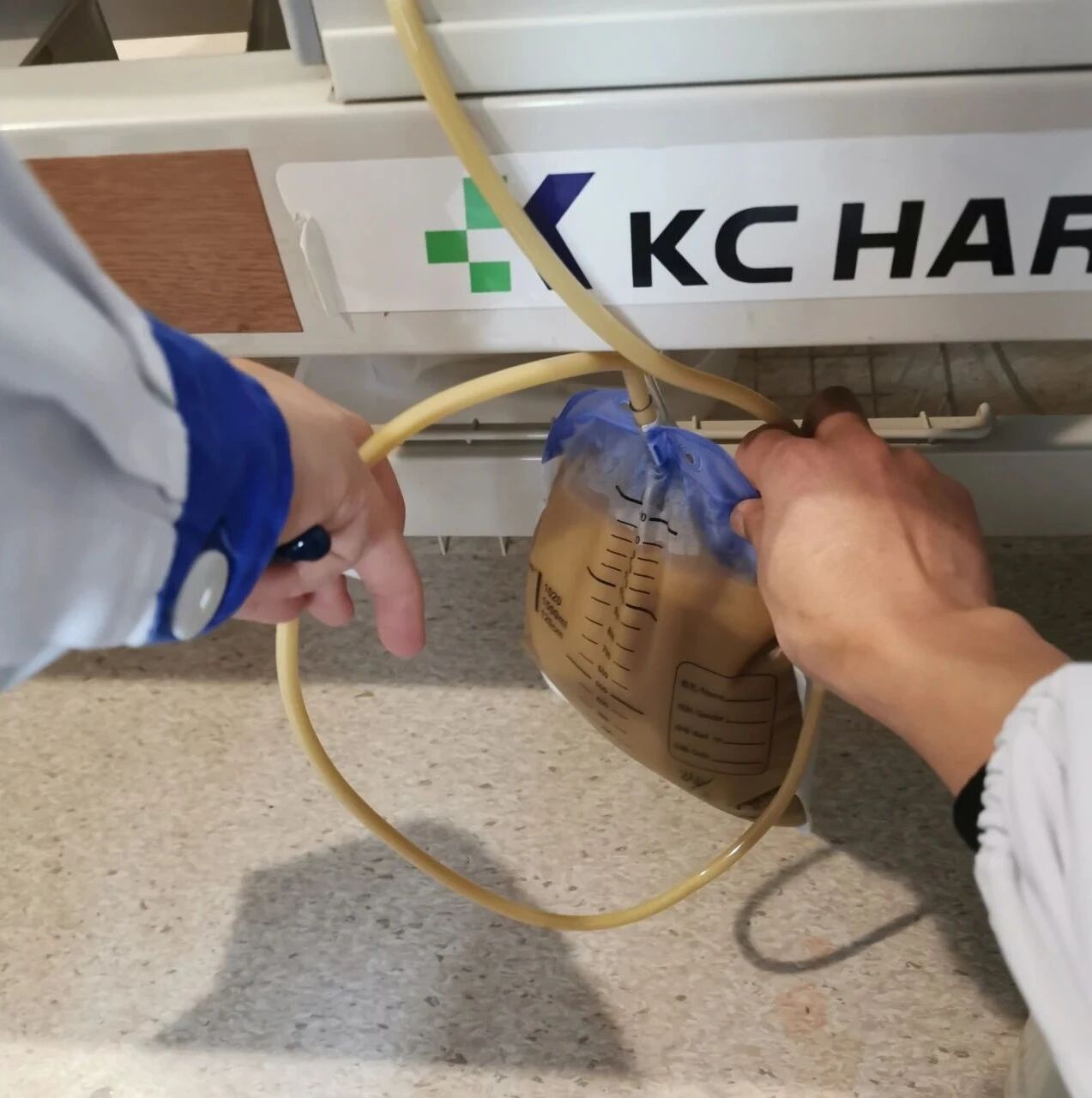 奇怪的“奶茶样胸水”，不要漏诊这种细菌