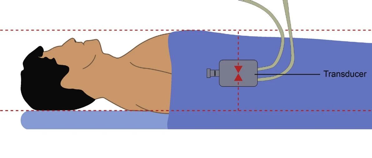时隔15年，肺动脉高压最新声明！│CCS/CTS