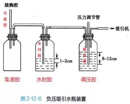 为什么负压引流胸腔闭式引流没有你想的那么简单_https://www.jmylbn.com_新闻资讯_第6张