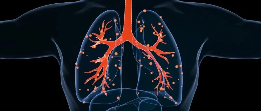 女子咳嗽，胸片说肺炎，医生让住院不肯，后续检查爆出大问题，这次腿都软了