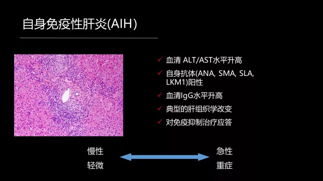 馬雄：20年鑽研自身免疫性肝病，爭研究型醫生金牌！ 健康 第16張