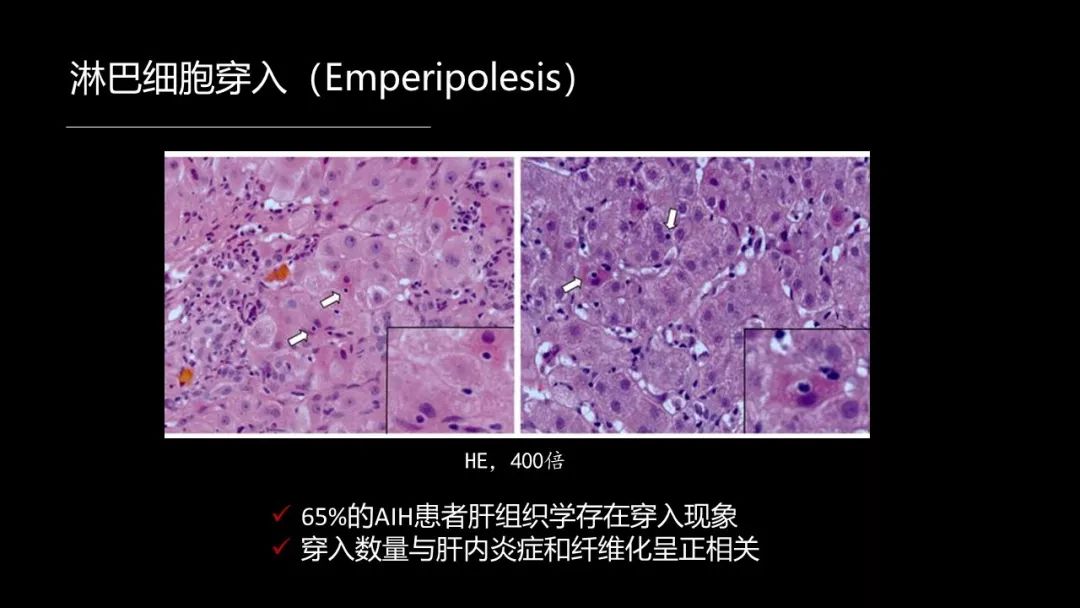 馬雄：20年鑽研自身免疫性肝病，爭研究型醫生金牌！ 健康 第18張