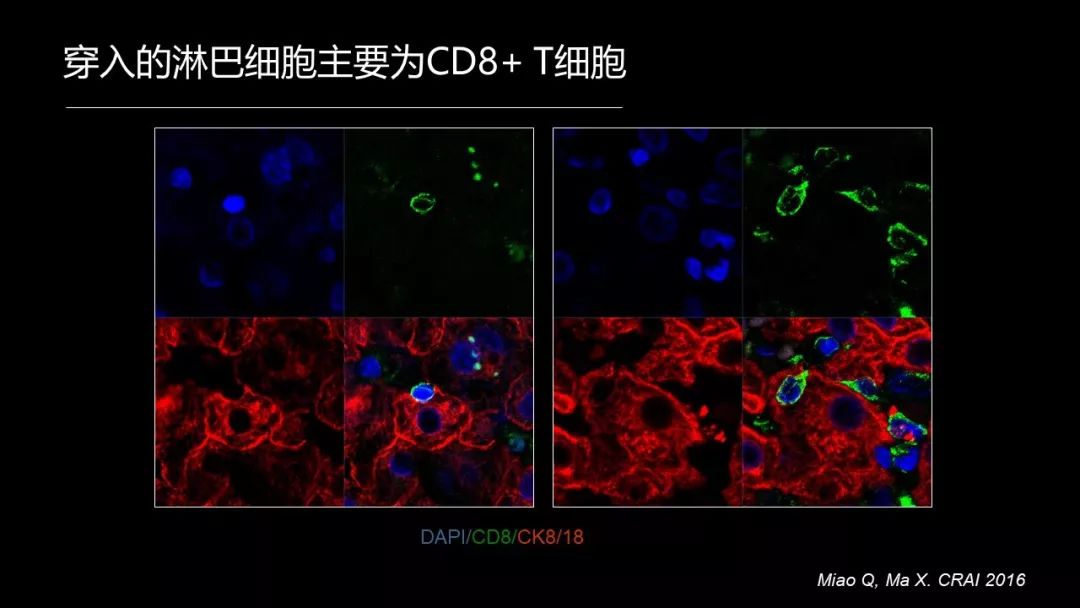 馬雄：20年鑽研自身免疫性肝病，爭研究型醫生金牌！ 健康 第19張