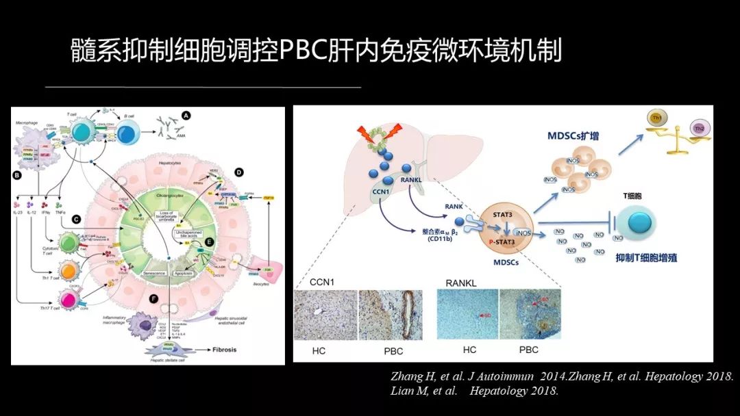 馬雄：20年鑽研自身免疫性肝病，爭研究型醫生金牌！ 健康 第41張