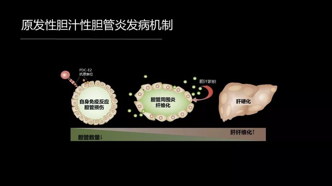 馬雄：20年鑽研自身免疫性肝病，爭研究型醫生金牌！ 健康 第32張