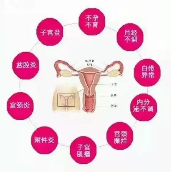 妇科臭氧冲洗怎么洗春季潮湿妇科炎症”蠢蠢欲动”，臭氧冲洗治疗仪解您难“炎”之隐！_https://www.jmylbn.com_新闻资讯_第4张