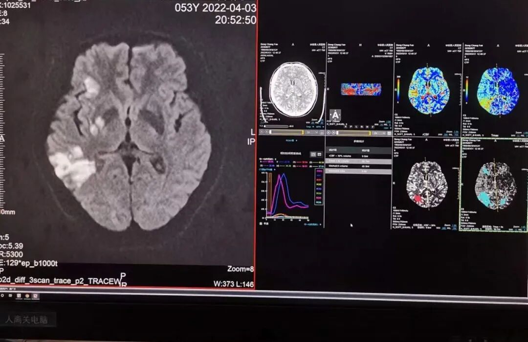 联影的CT怎么样【新设备】我院放射科联影80排CT正式投入使用_https://www.jmylbn.com_新闻资讯_第10张