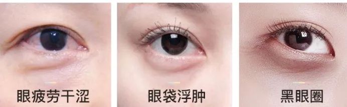 你的眼,我呵护,每日一次草本SPA,唤醒明亮双眸!blingbling明眸再现!