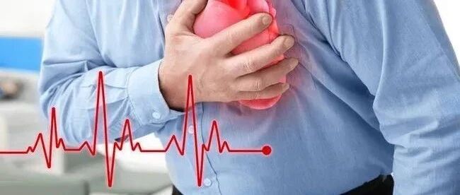 重点关注：能够致命的病——心肌梗死！