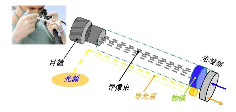 内窥镜导光束怎么更换一文看懂硬性内窥镜和软性内窥镜的区别！_https://www.jmylbn.com_新闻资讯_第6张