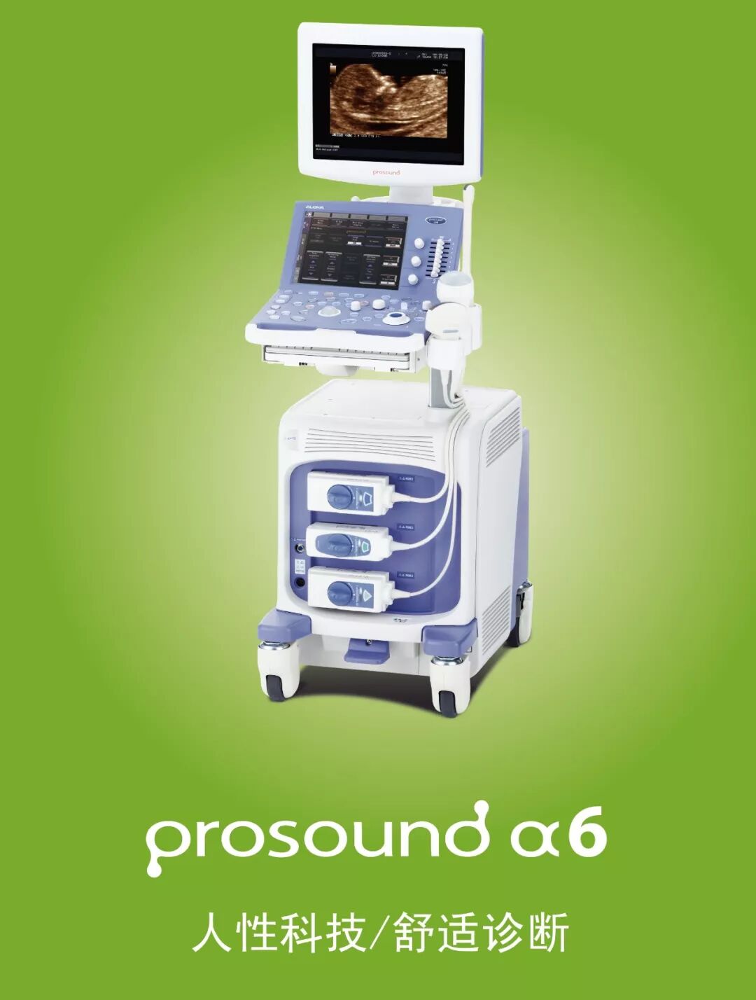 日立超声怎么样【史上最全】日立超声机型介绍，绝对的干货_https://www.jmylbn.com_新闻资讯_第11张