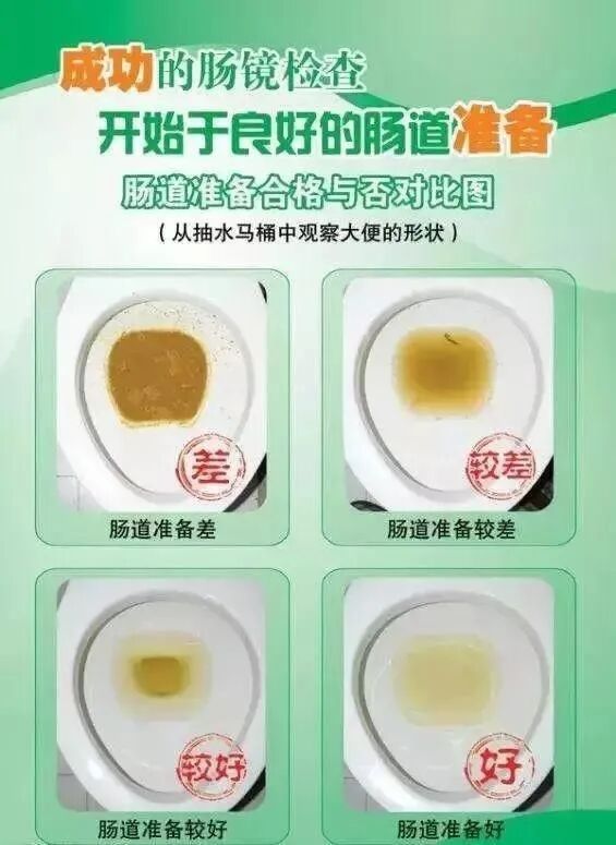 电子胃镜镜是什么一篇搞懂！你们最关心的胃肠镜攻略来喽！_https://www.jmylbn.com_新闻资讯_第2张