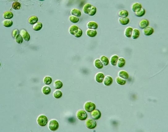 四孢藻 范老师微藻物联世界 微信公众号文章阅读 Wemp