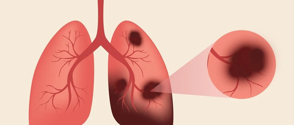 12岁！肺癌晚期！13岁！糖尿病！妈妈崩溃说出几个细节，很多家长都没当回事…